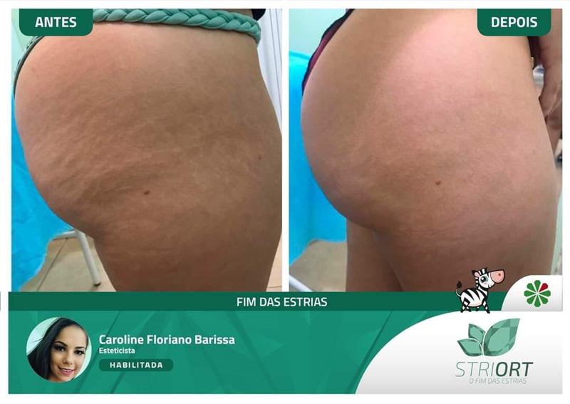 Antes e depois — profissional Caroline Floriano Barissa
