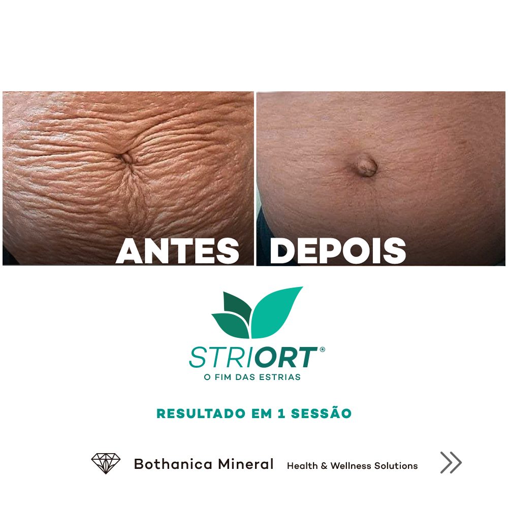 Antes e depois com o método STRIORT — Book de Resultados