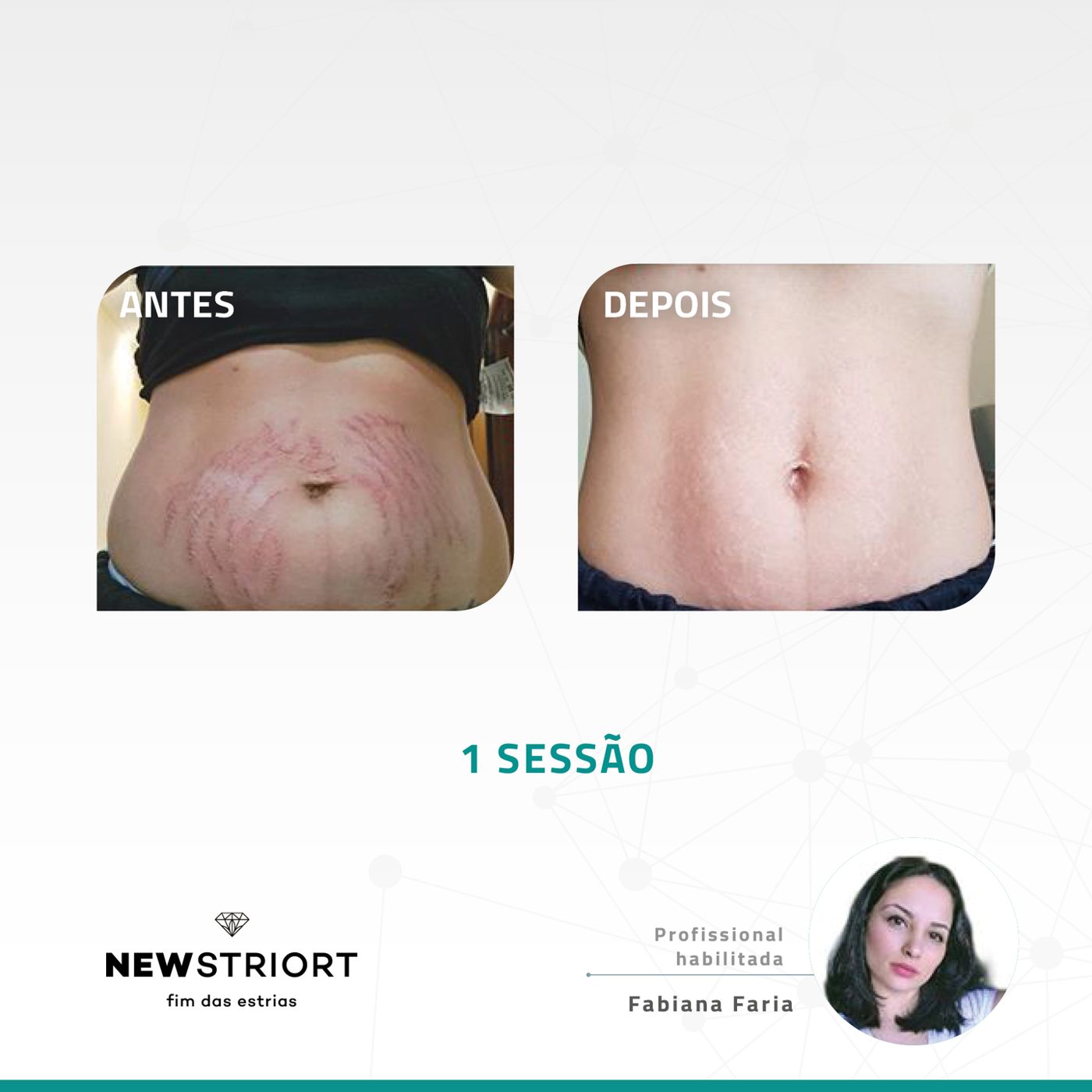 Antes e depois com o método STRIORT — Book de Resultados