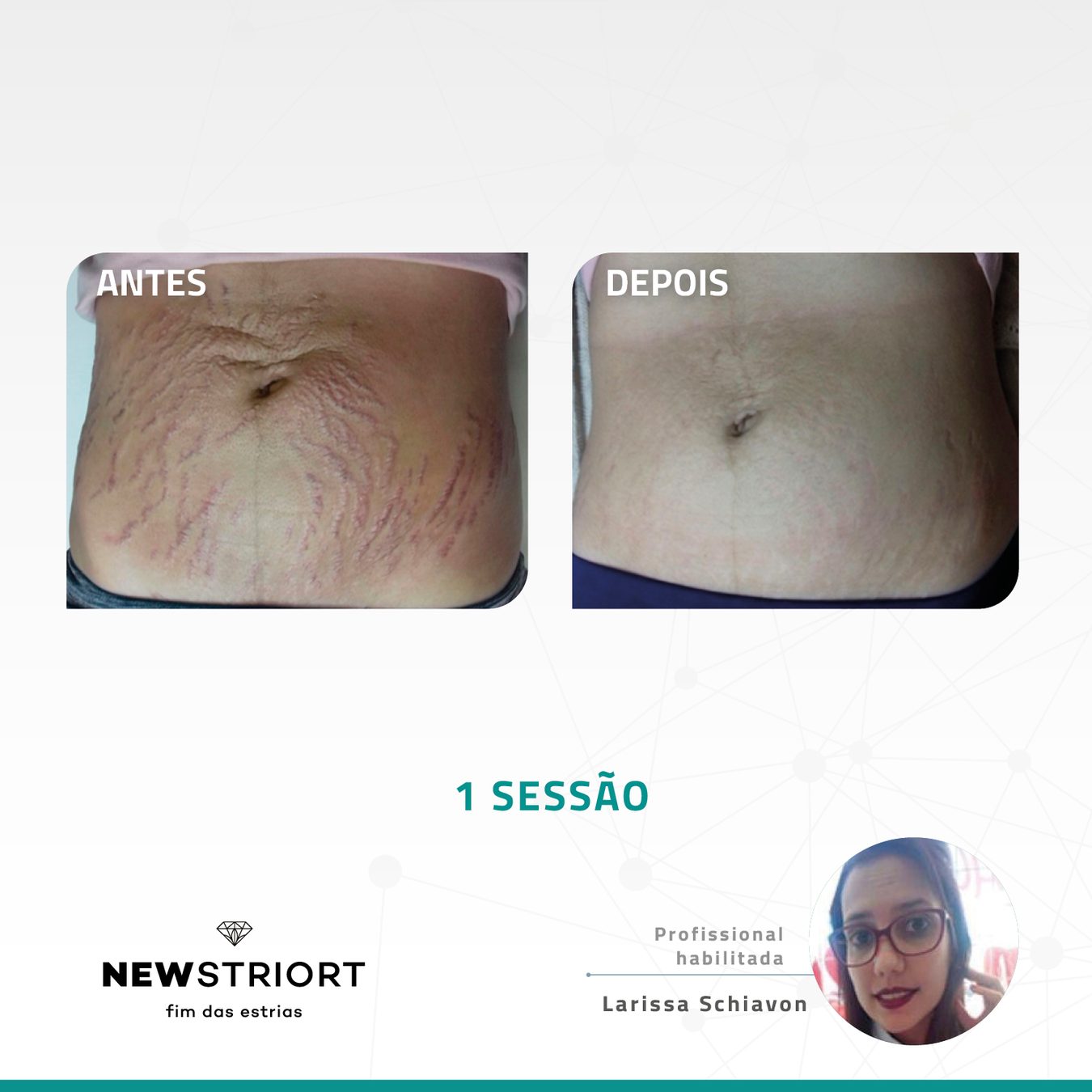 Antes e depois com o método STRIORT — Book de Resultados