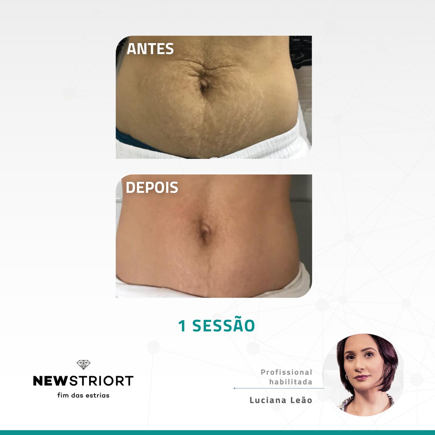 Antes e depois com o método STRIORT — Book de Resultados