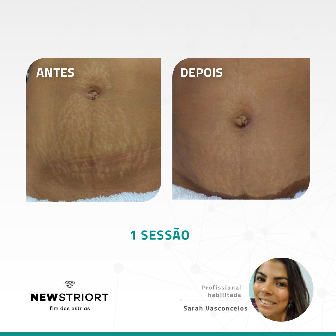 Antes e depois com o método STRIORT — Book de Resultados