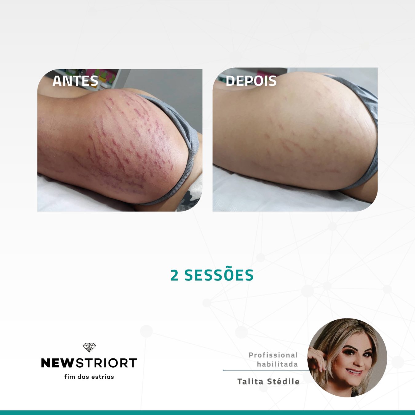 Antes e depois com o método STRIORT — Book de Resultados