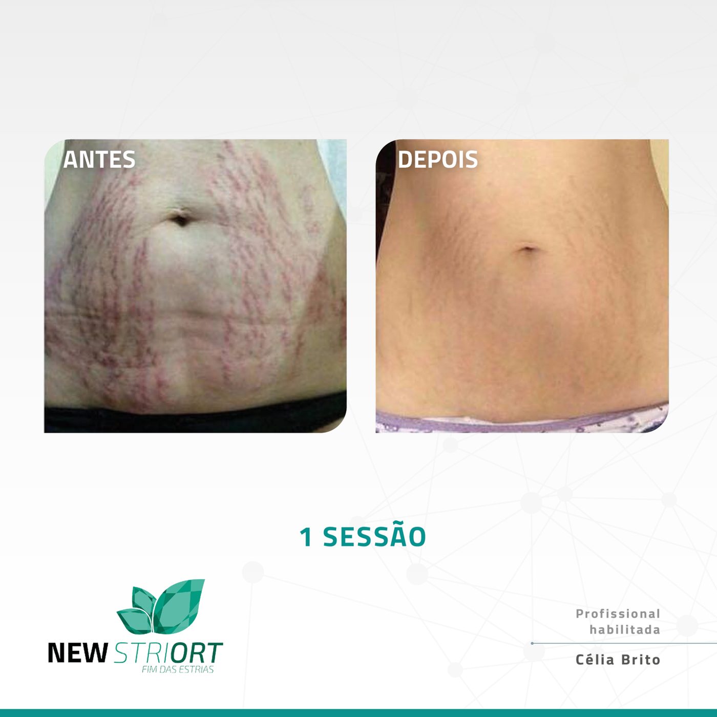 Antes e depois com o método STRIORT — Book de Resultados