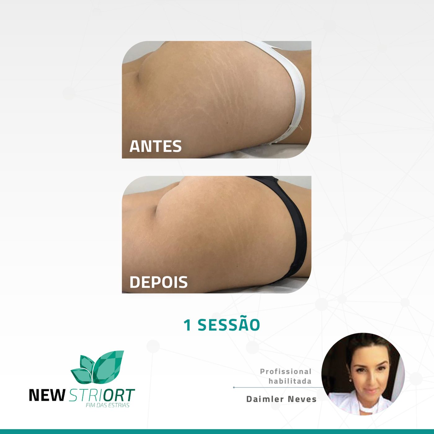 Antes e depois com o método STRIORT — Book de Resultados