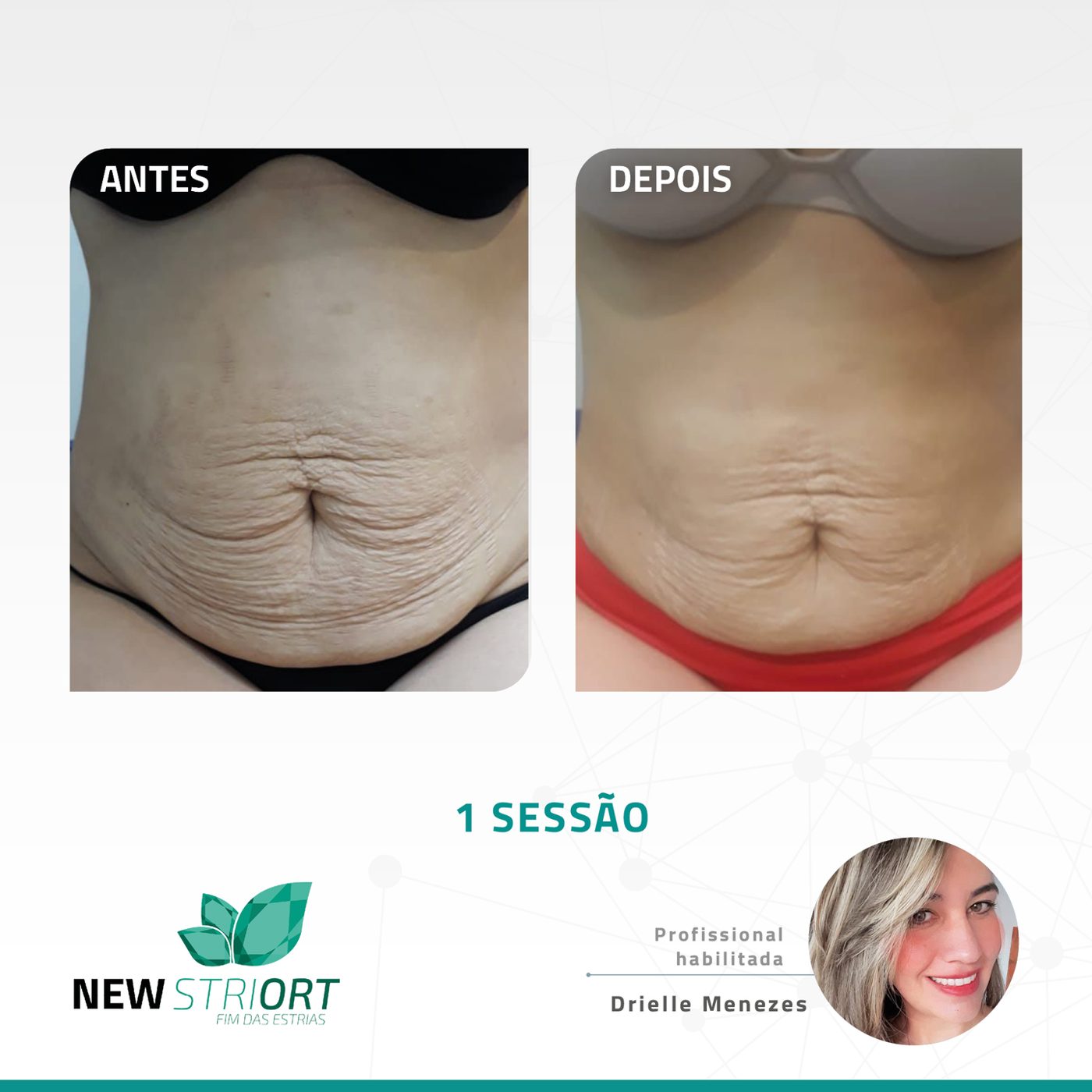 Antes e depois com o método STRIORT — Book de Resultados