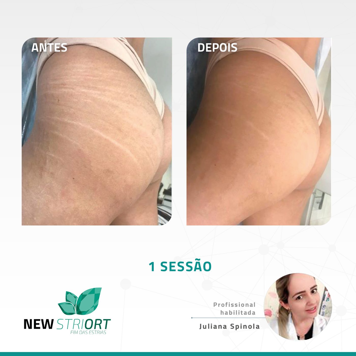 Antes e depois com o método STRIORT — Book de Resultados