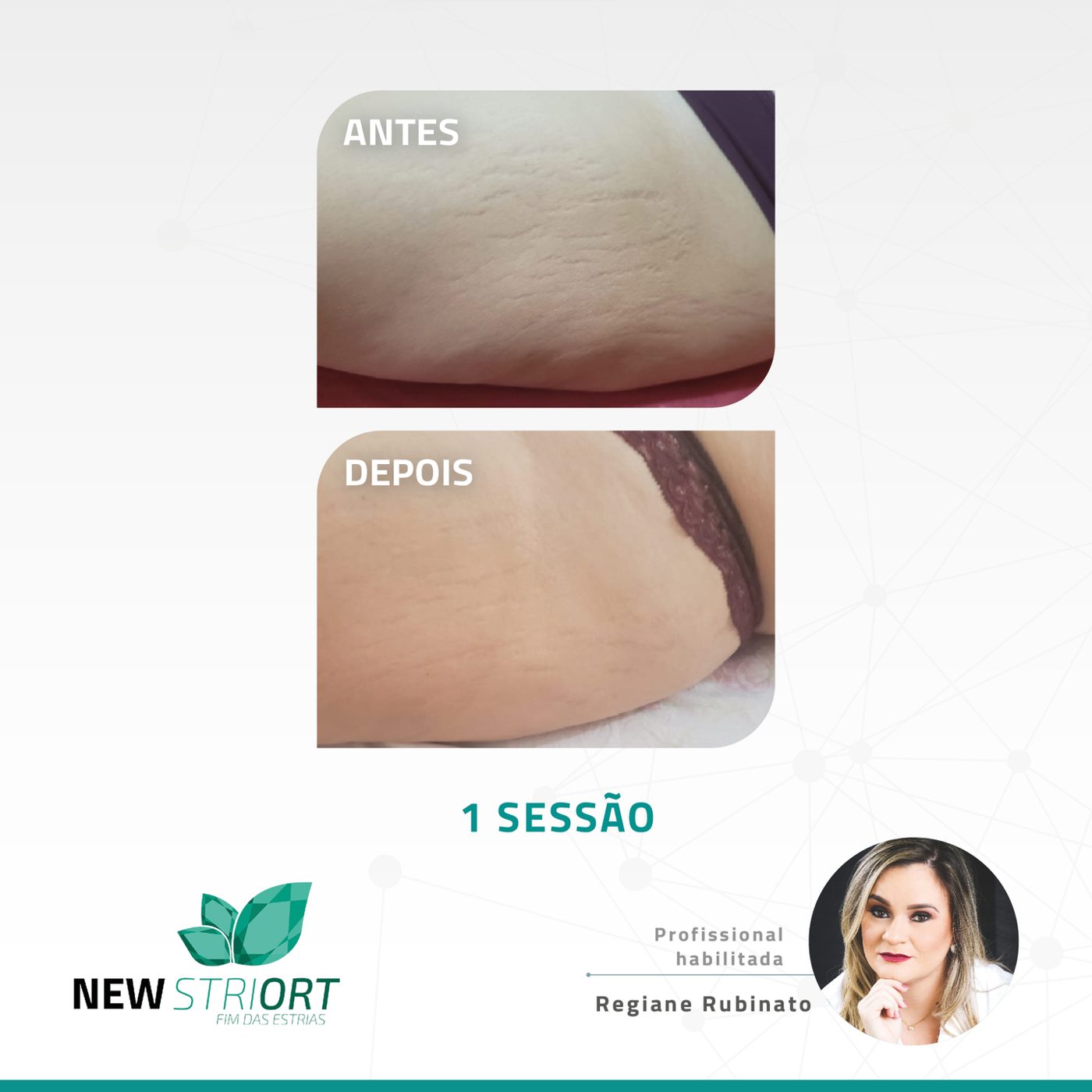 Antes e depois com o método STRIORT — Book de Resultados