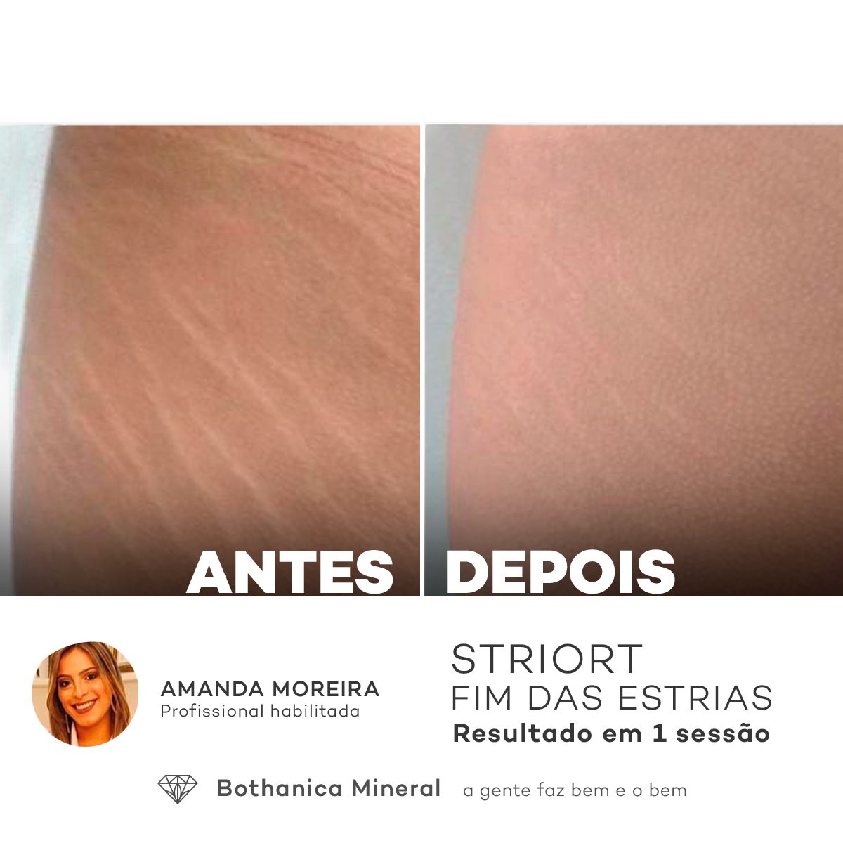 Antes e depois com o método STRIORT — Book de Resultados
