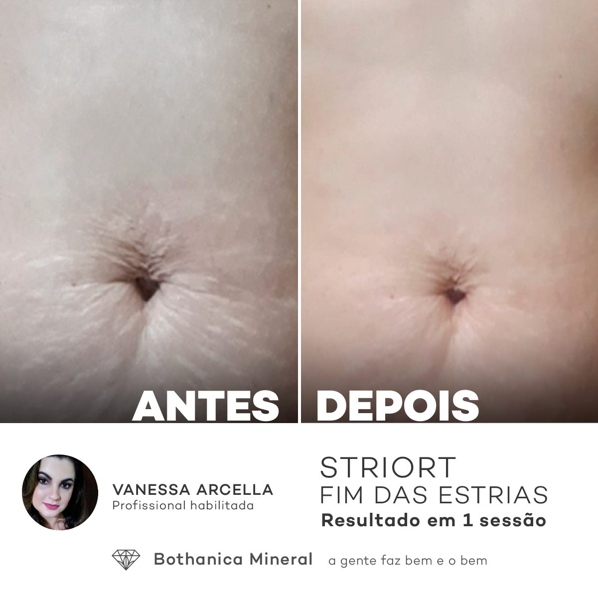 Antes e depois com o método STRIORT — Book de Resultados