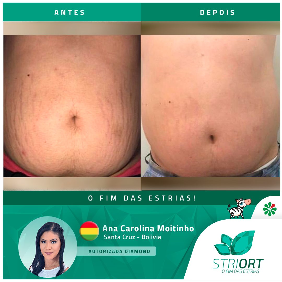 Antes e depois com o método STRIORT — Book de Resultados
